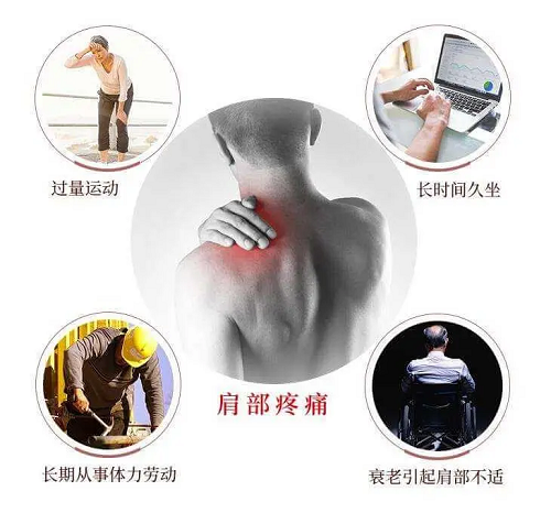 肩部疼痛常見(jiàn)原因