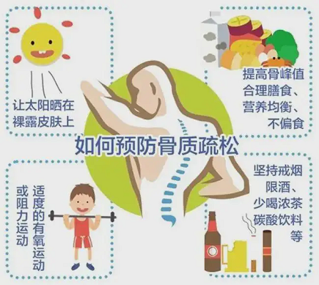 如何預(yù)防骨質(zhì)疏松